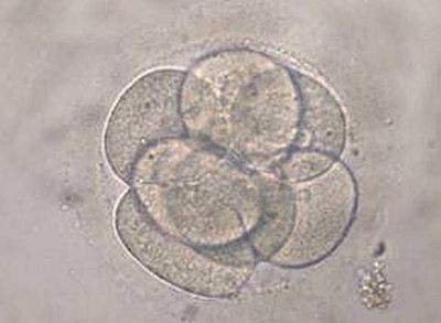 Корейские учёные создали клонированный эмбрион человека